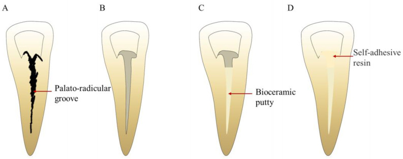 Figure 12