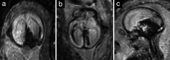 UOG-26129-FIG-0005-b