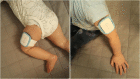 Fig. 1