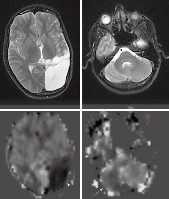 Figure 14