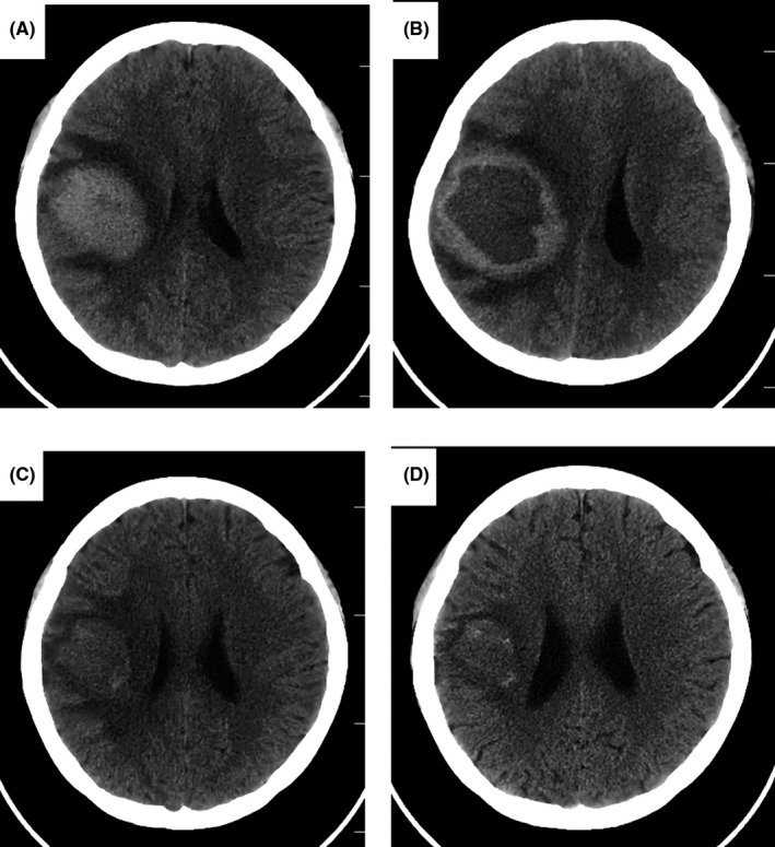 FIGURE 1