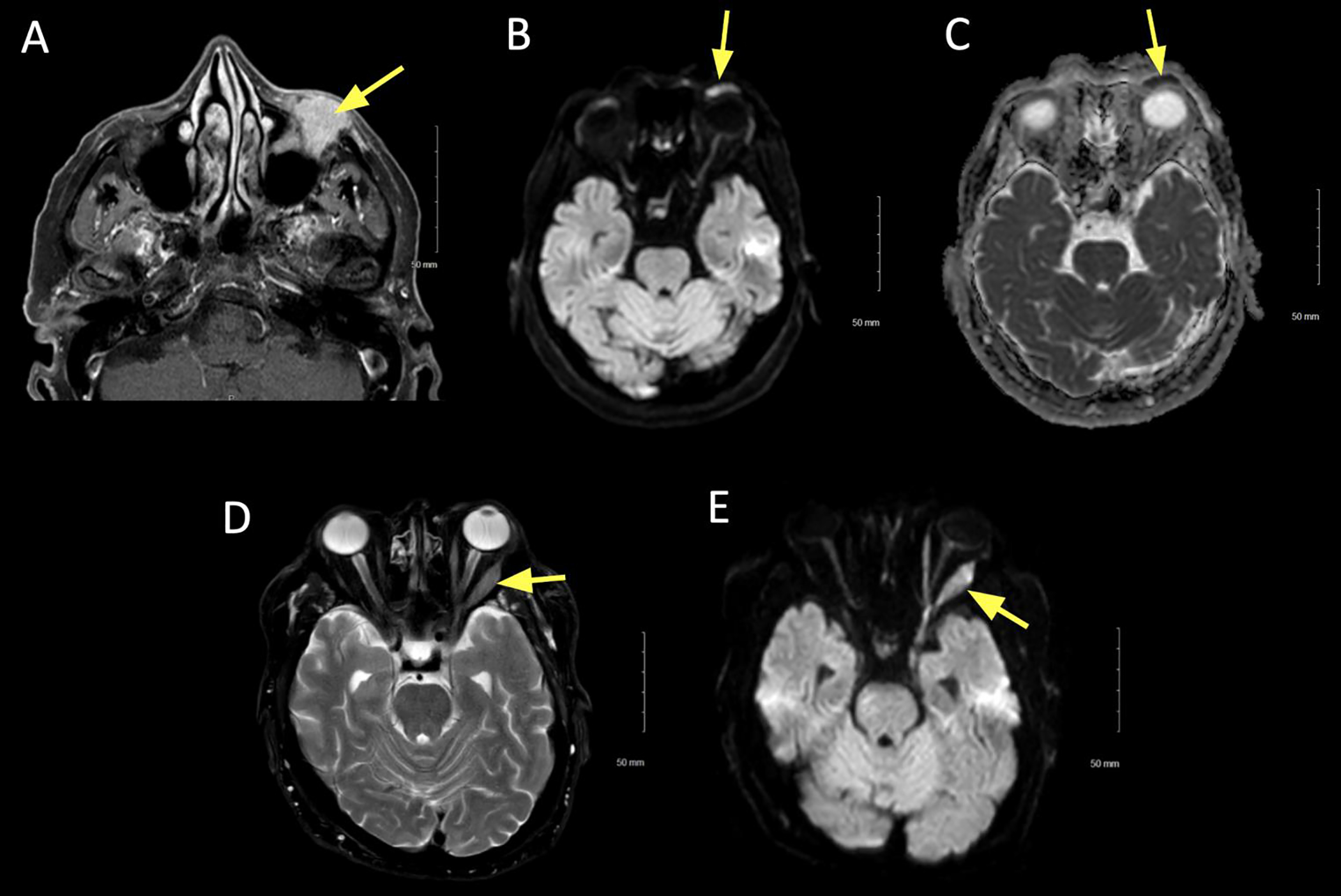 Figure 3: