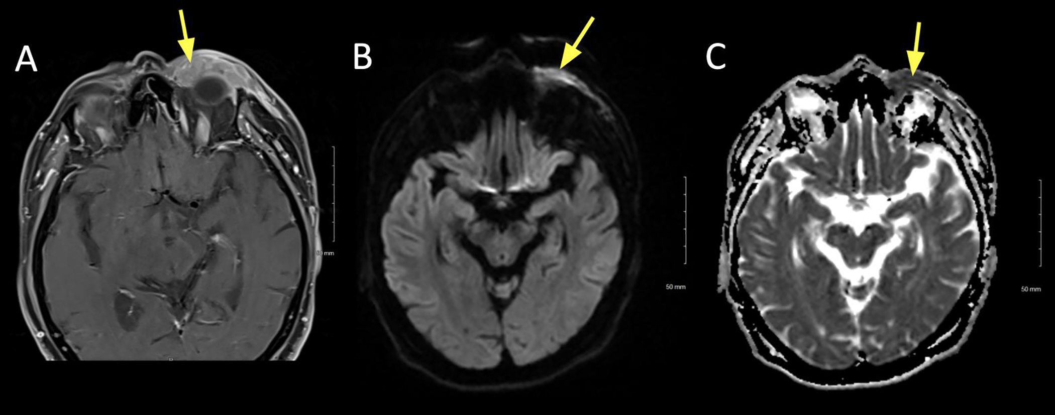 Figure 4: