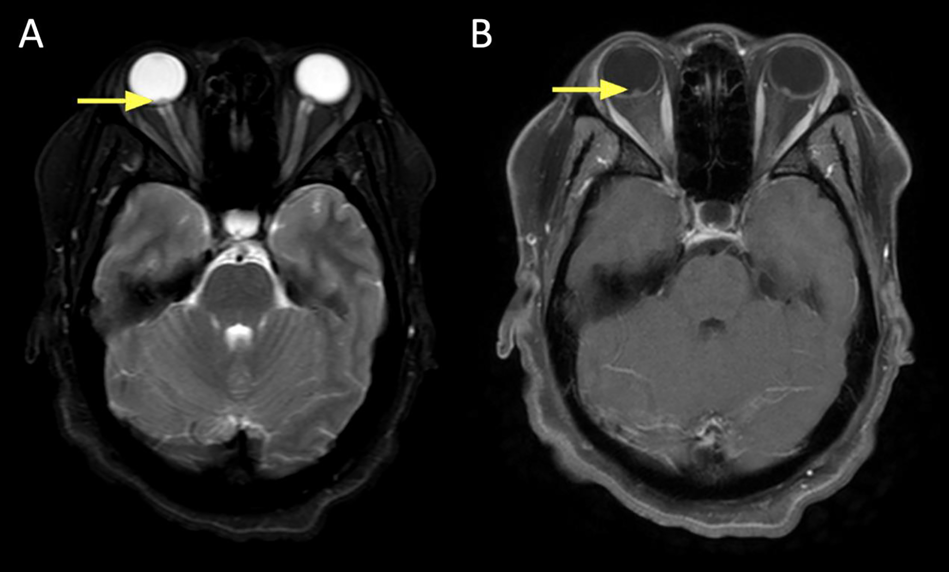 Figure 6: