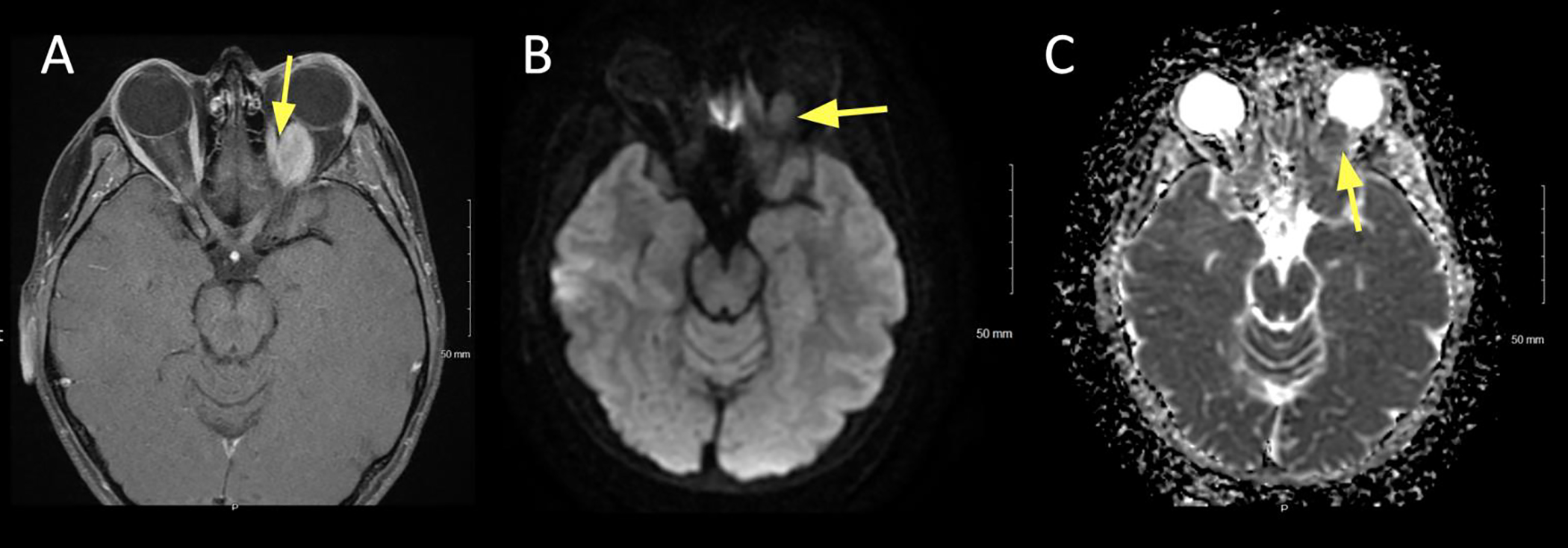 Figure 2: