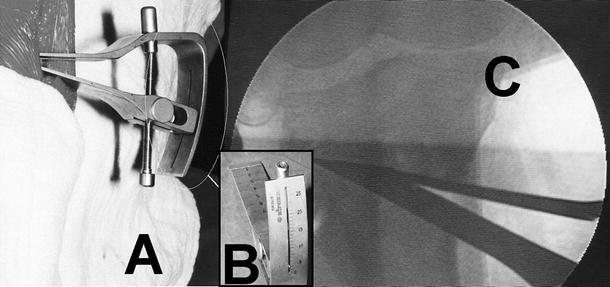 Fig. 9