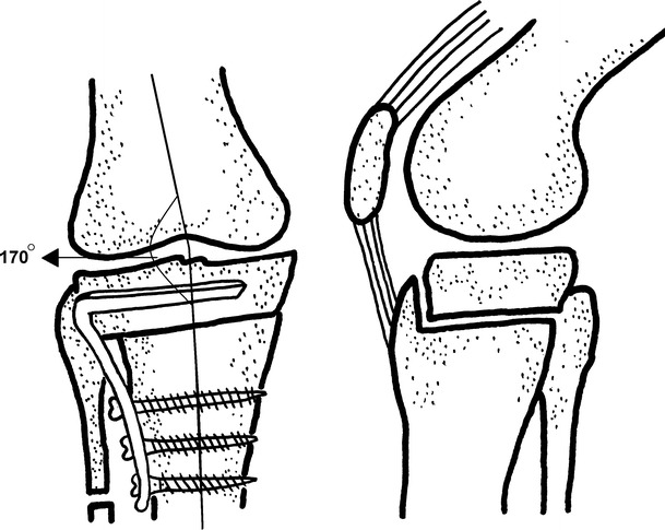 Fig. 4