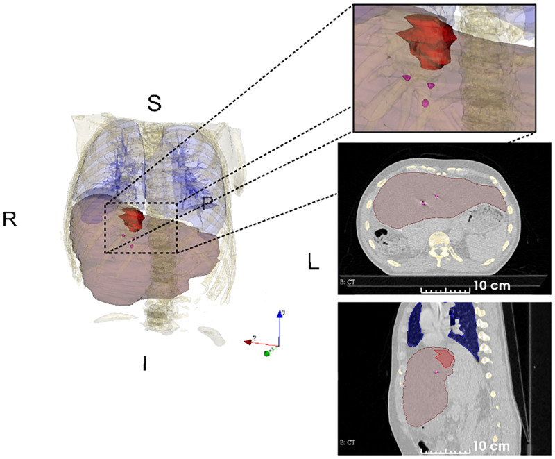 Fig 1