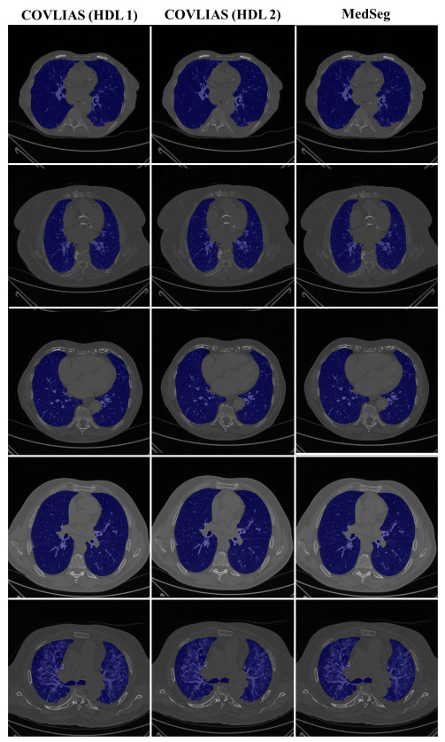 Figure 23