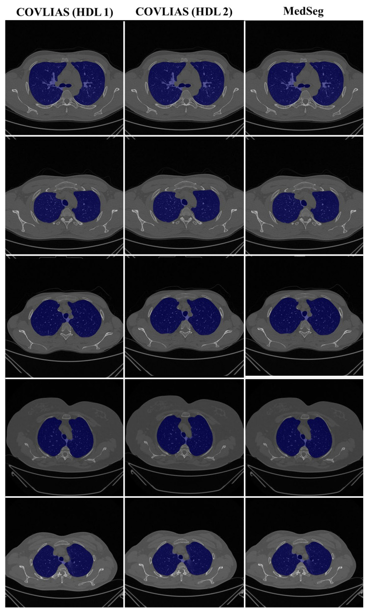 Figure 22