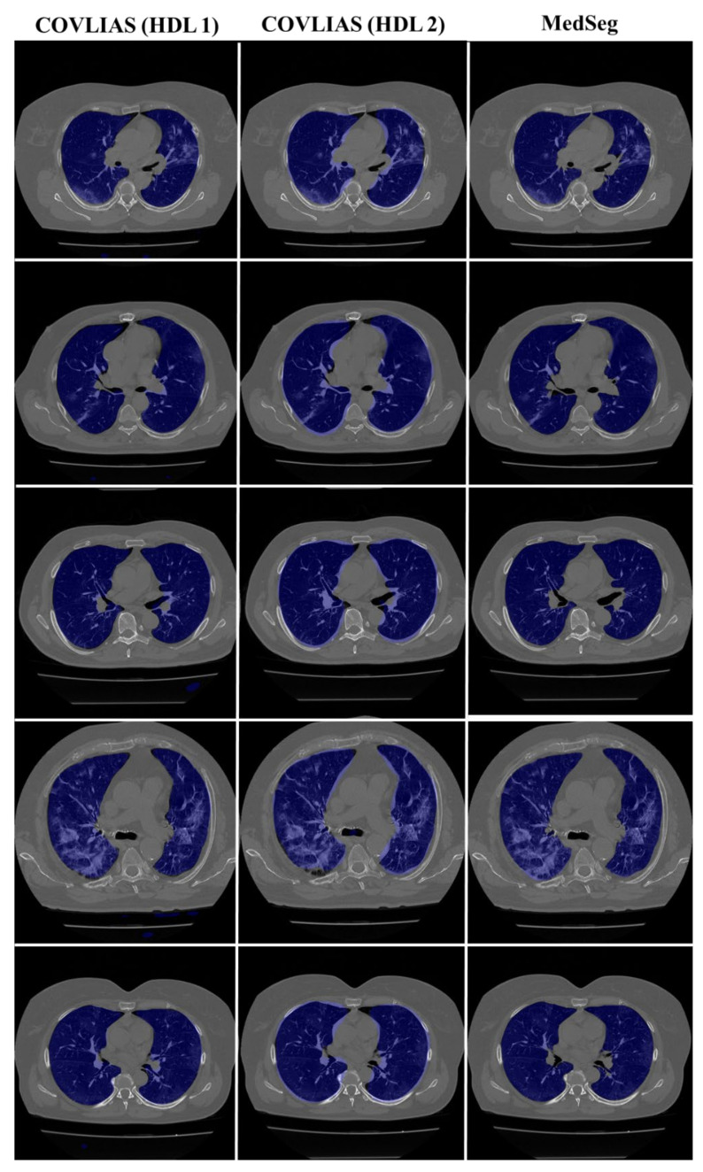 Figure 20