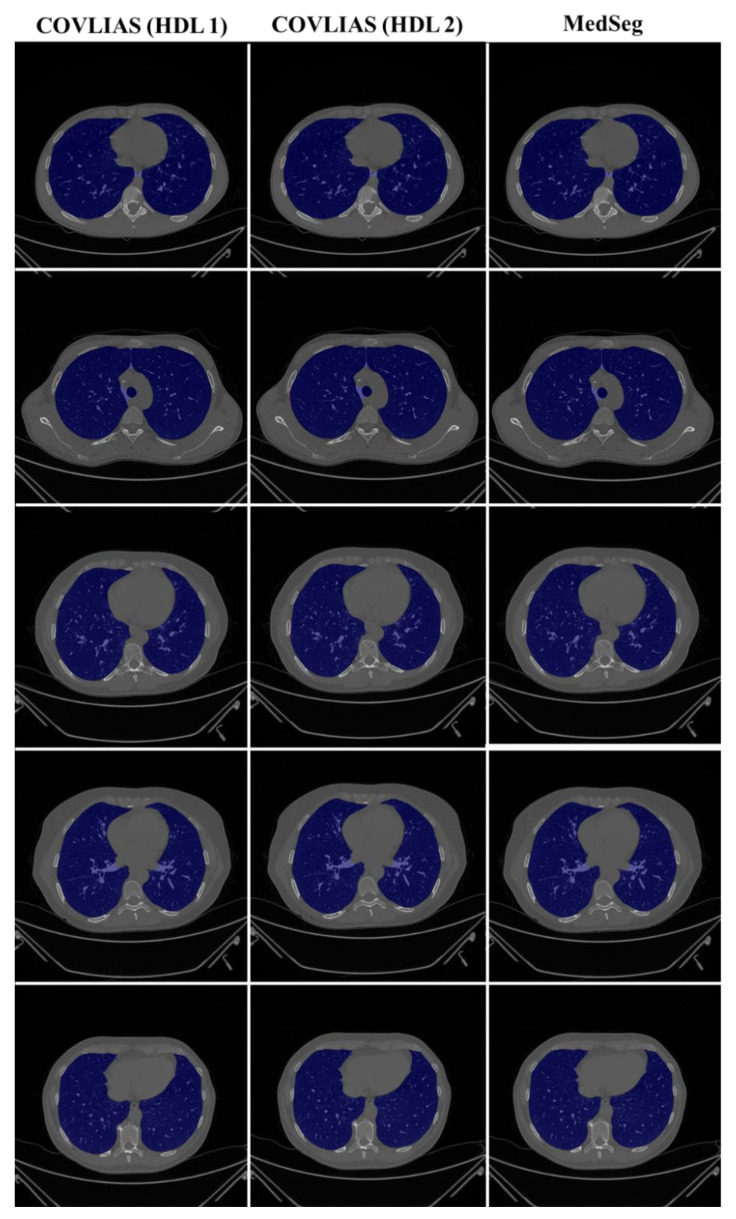 Figure 21