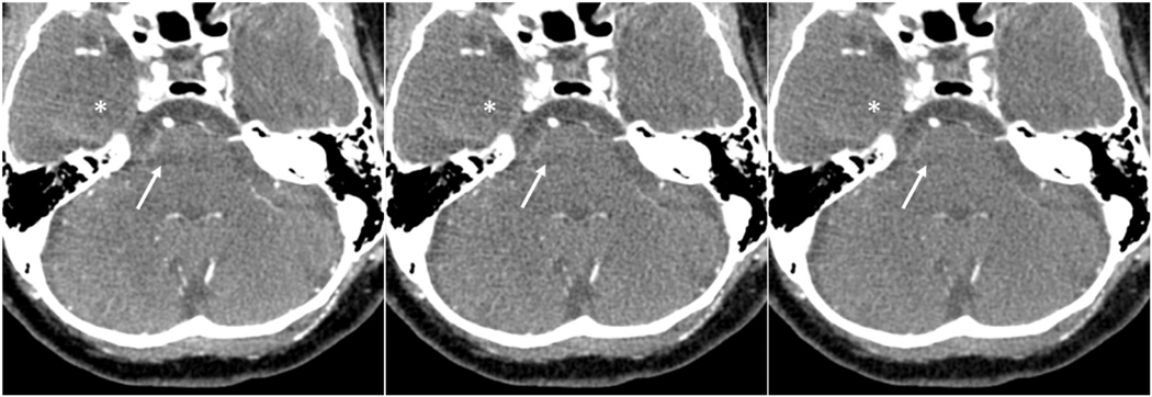 Figure 4: