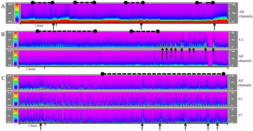 FIG. 4.