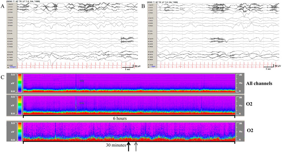 FIG. 2.