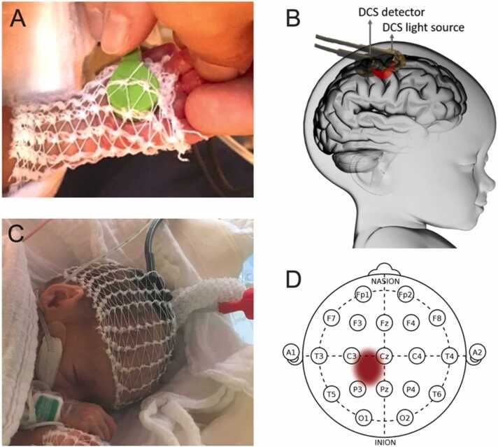 Fig. 2