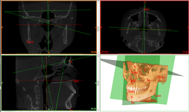 Fig. 2