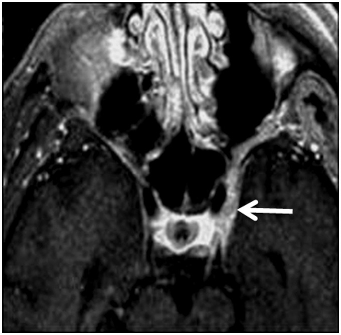 Figure 12.