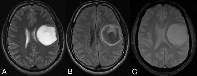 Fig 1.