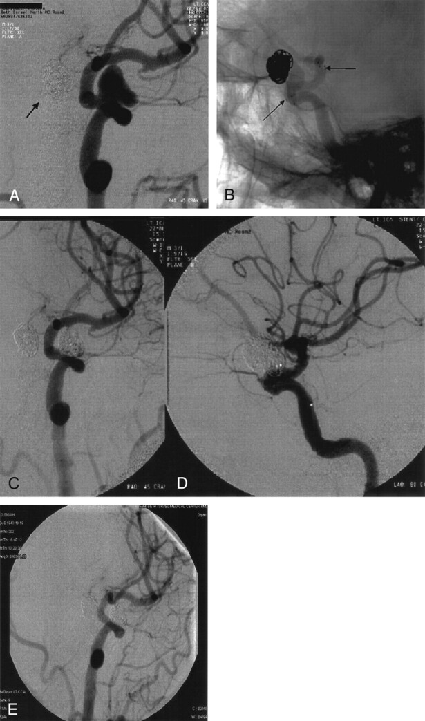 Fig 2.