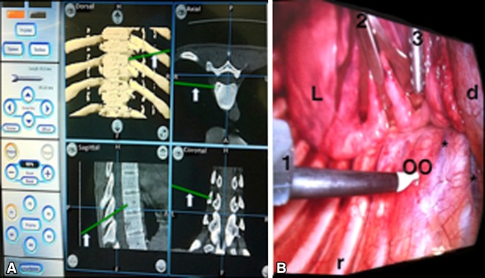 Fig. 4A–B