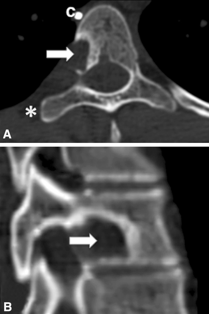 Fig. 6A–B