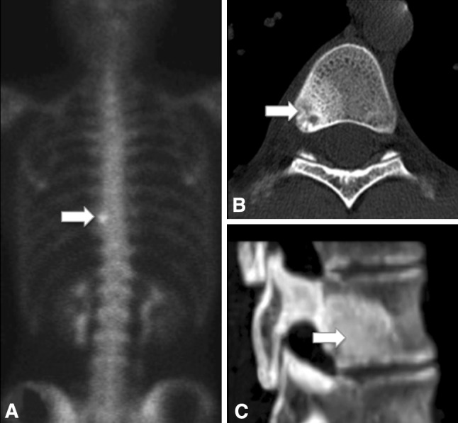 Fig. 2A–C