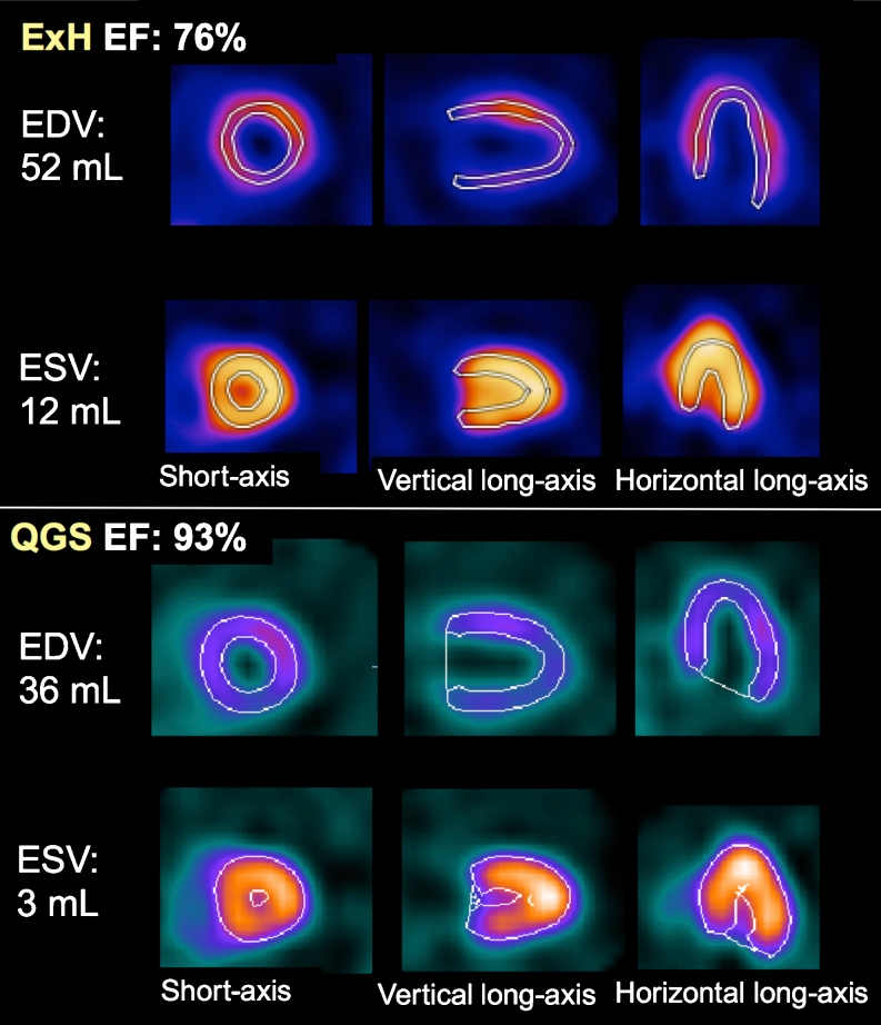 Fig. 4