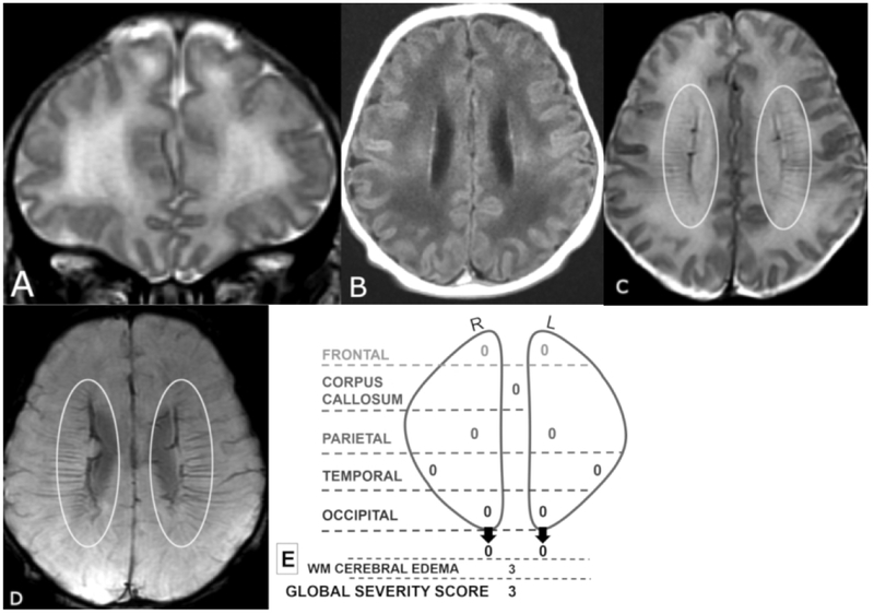 Figure 1 A-E.