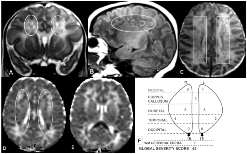 Figure 4 A-F.