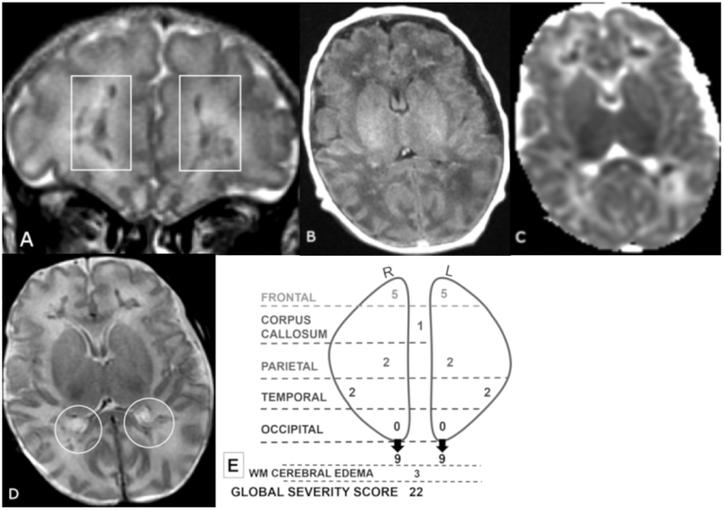 Figure 3 A-E.