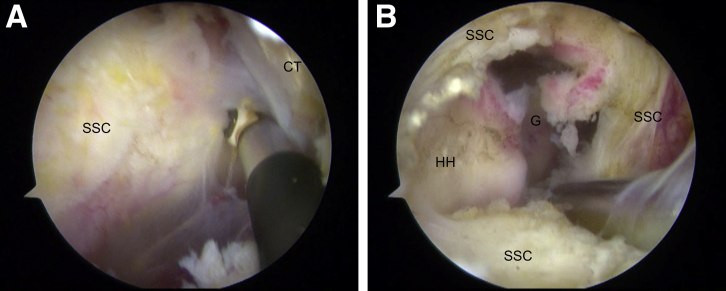 Fig 4