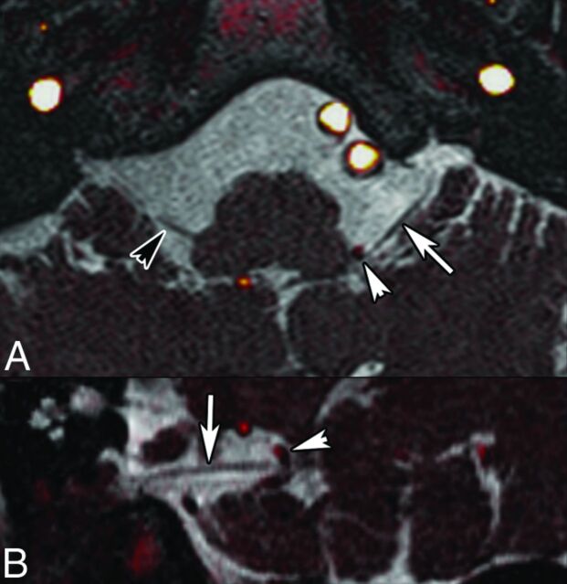 Fig 11.