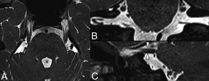 Fig 2.