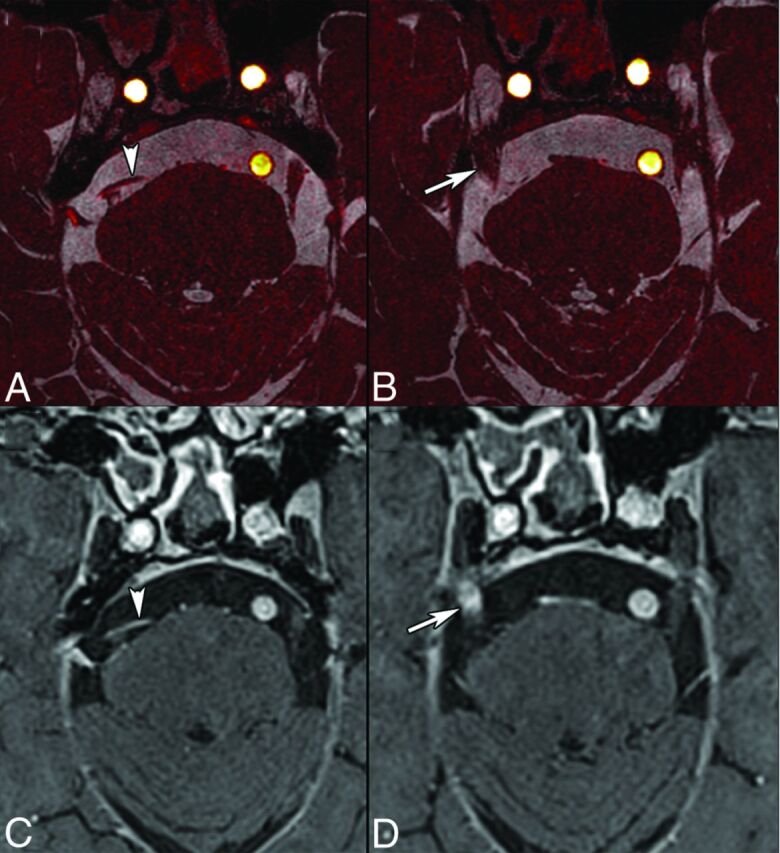 Fig 6.