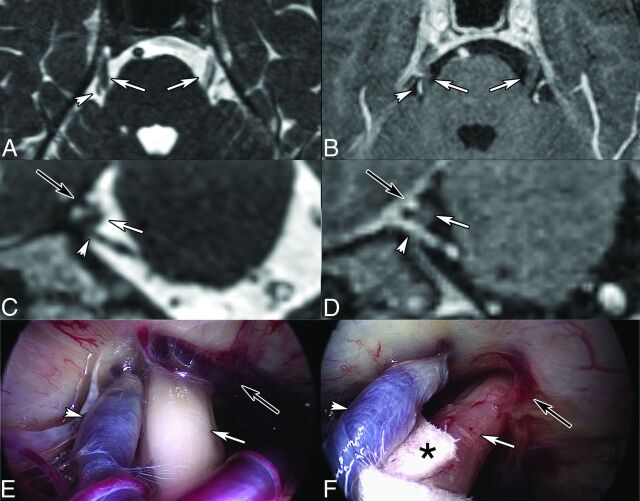 Fig 4.