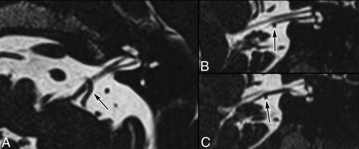 Fig 9.