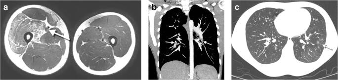 Fig. 17