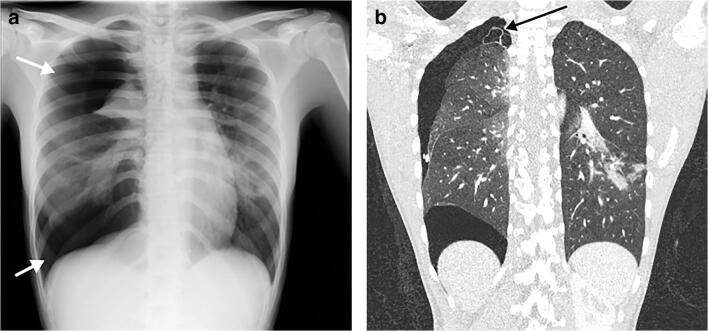 Fig. 8