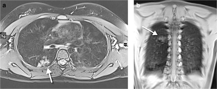 Fig. 16