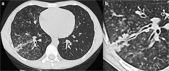 Fig. 15