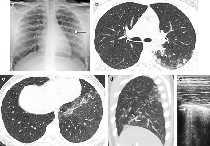 Fig. 13