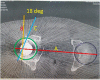 Fig. 25