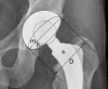 Fig. 22