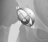 Fig. 23