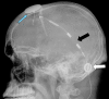 eFigure 3