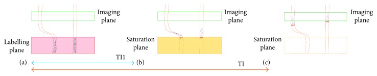 Figure 14