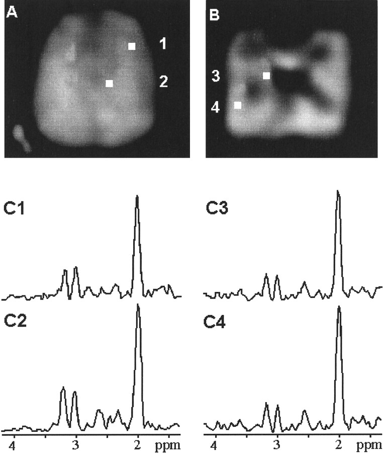 fig 2.