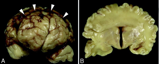 Fig 2.