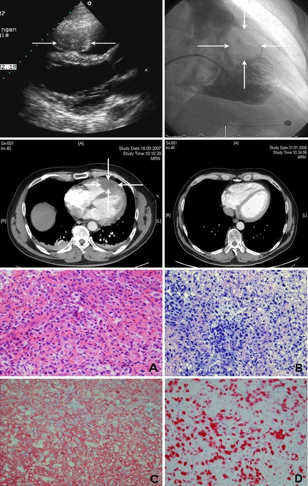 Fig. 1